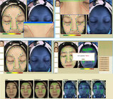 da máquina facial da análise da pele da dermatologia 3d analisador facial 40W da pele do varredor